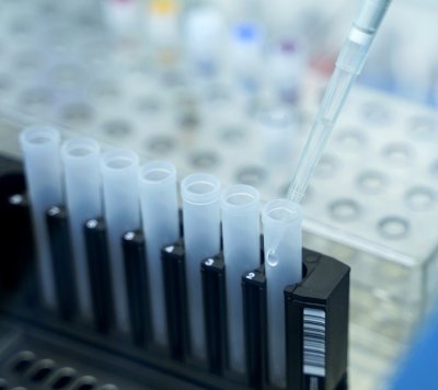 Светът в борба с COVID-19: Канада затвори границите, в САЩ ваксинират доброволци с тестов препарат