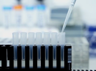 20 млн. на месец ще струва тестването на гражданите за COVID-19