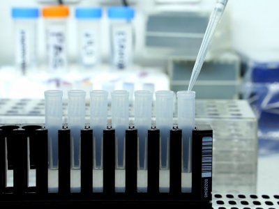 5 нови случая на COVID-19 в страната, общият брой на регистрираните става 359