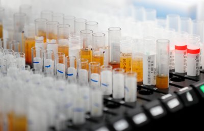Близо 3 милиона и 700 000 са заразените с коронавирус в света