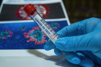 Тестват за коронавирус 650 служители от социални заведения в Пловдивско